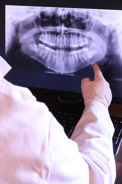 Best Dental Abscess Treatment in Santa Barbara, CA